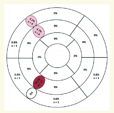 segment-American-Heart-Association-bulls-eye-plot-demonstrating-the-distribution-of.png