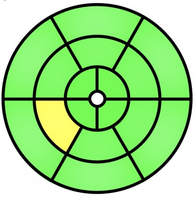 bullseye - revised.jpg