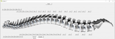 Spinal Model.jpg